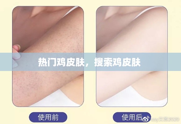 热门鸡皮肤，搜索鸡皮肤 