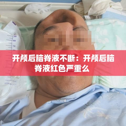 开颅后脑脊液不断：开颅后脑脊液红色严重么 