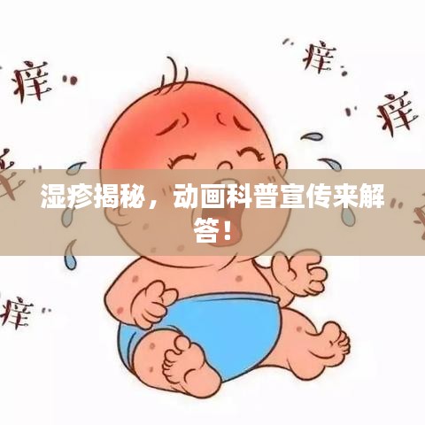 湿疹揭秘，动画科普宣传来解答！