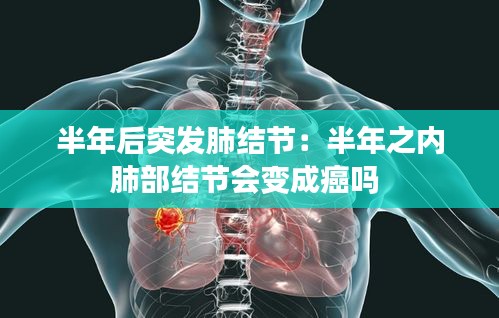 半年后突发肺结节：半年之内肺部结节会变成癌吗 