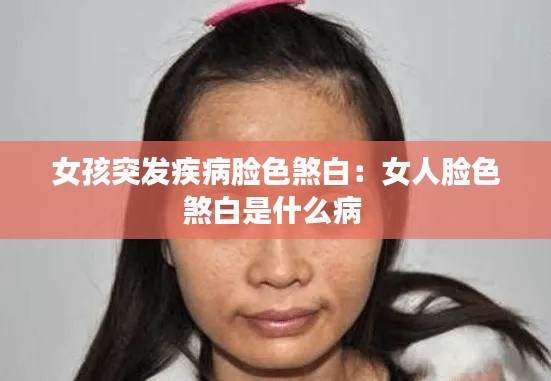 女孩突发疾病脸色煞白：女人脸色煞白是什么病 