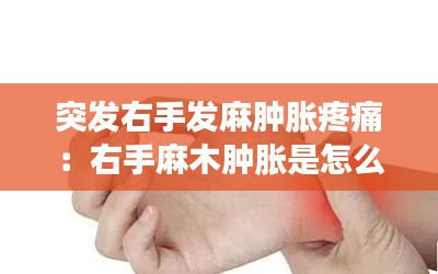 突发右手发麻肿胀疼痛：右手麻木肿胀是怎么了 