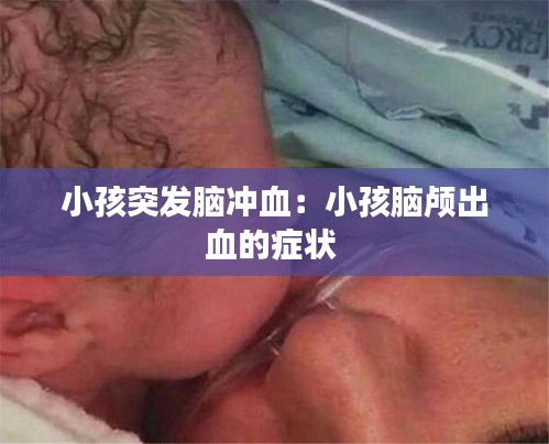 小孩突发脑冲血：小孩脑颅出血的症状 