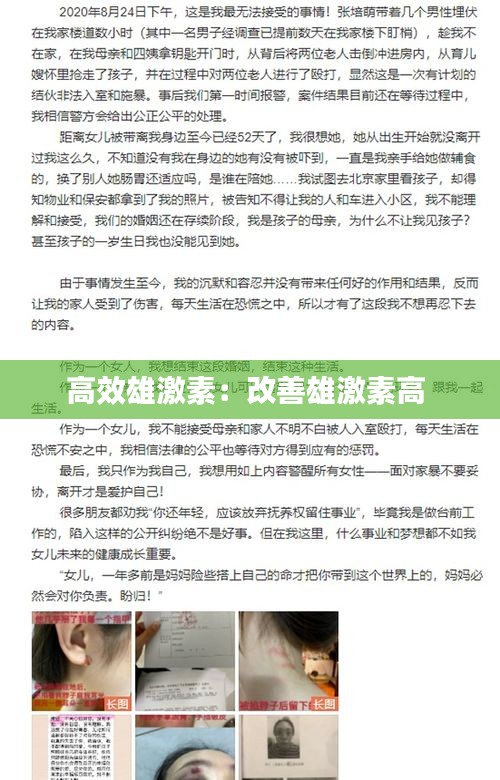 高效雄激素：改善雄激素高 