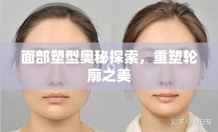 面部塑型奥秘探索，重塑轮廓之美