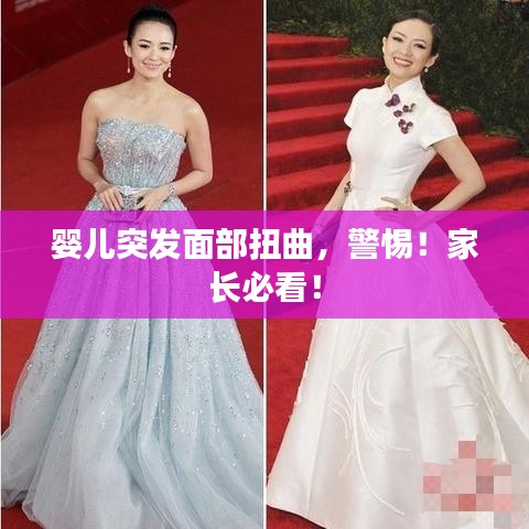 婴儿突发面部扭曲，警惕！家长必看！