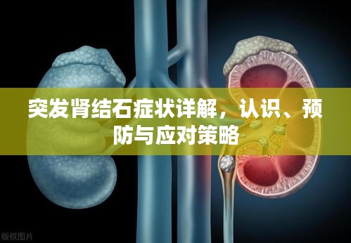 突发肾结石症状详解，认识、预防与应对策略