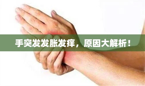 手突发发胀发痒，原因大解析！