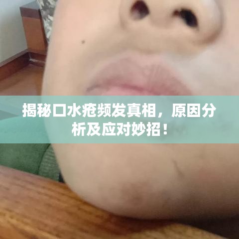 揭秘口水疮频发真相，原因分析及应对妙招！