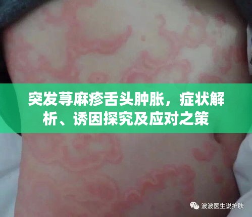 突发荨麻疹舌头肿胀，症状解析、诱因探究及应对之策