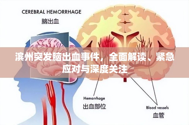 滨州突发脑出血事件，全面解读、紧急应对与深度关注