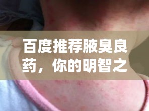 见缝就钻