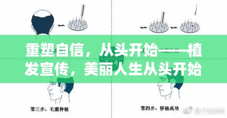 重塑自信，从头开始——植发宣传，美丽人生从头开始！
