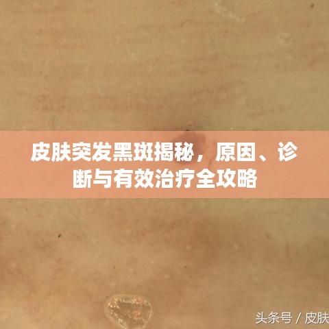 皮肤突发黑斑揭秘，原因、诊断与有效治疗全攻略